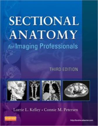 Test Bank for Sectional Anatomy for Imaging Professionals, 3rd Edition, Lorrie L. Kelley