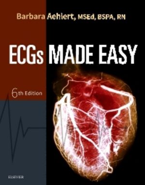 Test Bank for ECGs Made Easy 6th Edition by Aehlert