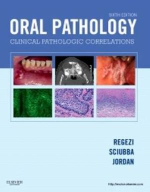Test Bank for Oral Pathology 6th Edition by Joseph Regezi